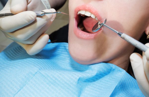 A dentist examining a patient’s teeth in the dentistry. A close-up of a patient’s teeth and mouth. A dentist examining a patient’s teeth in the dentistry. A close-up of a patient’s teeth and mouth.