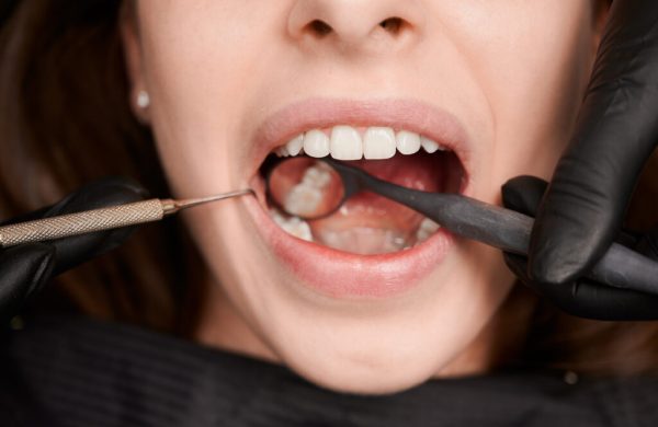 Macro photography of a beautiful female smile with white healthy teeth Close-up, cropped snapshot of good looking woman at dentist office during teeth checkup. Dentist examining patient's teeth with mirror and explorer. Oral hygiene concept